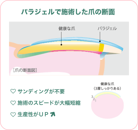 パラジェルで施術した爪の断面